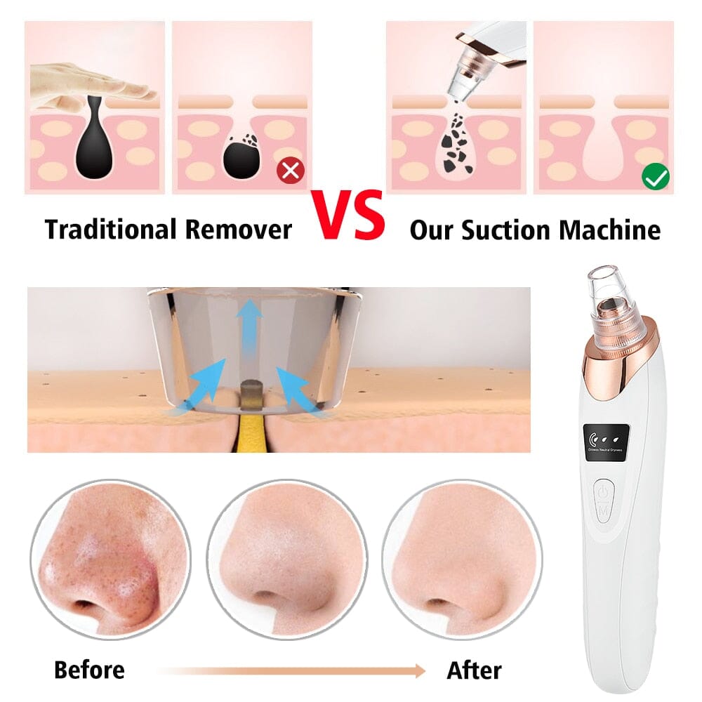 Vacuum Electric Blackhead Remover Cleaner - Tweety