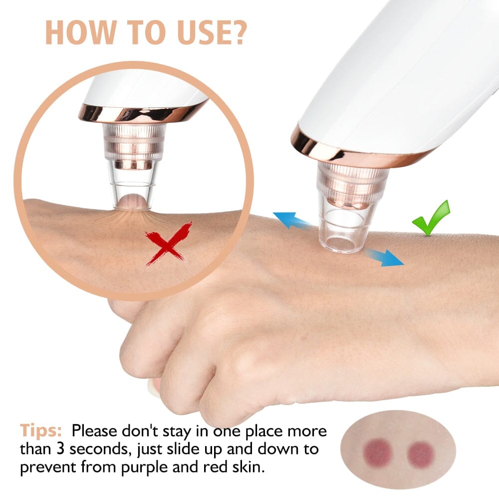 Vacuum Electric Blackhead Remover Cleaner - Tweety